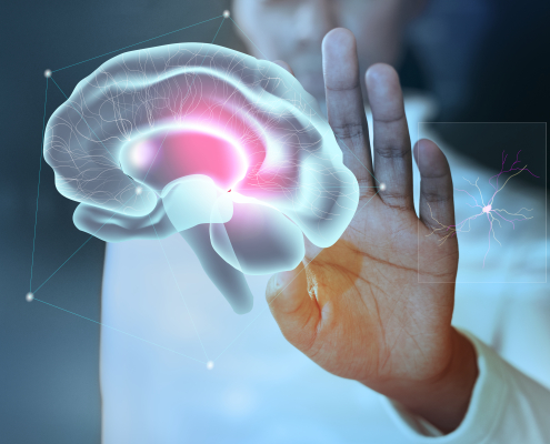 Alzheimer